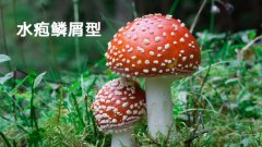 脚气治不好，你肯定没做对这些事