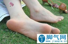脚臭是什么原因？除脚臭的10个最简单方法